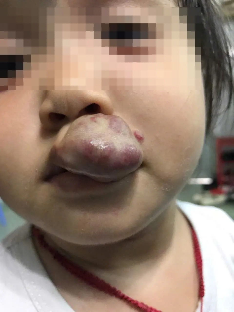 buou mau phat trien nhanh can kiem soat som 6